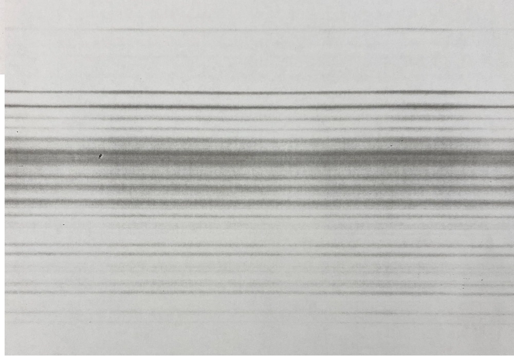 Difetti di stampa fotocopiatore Kyocera